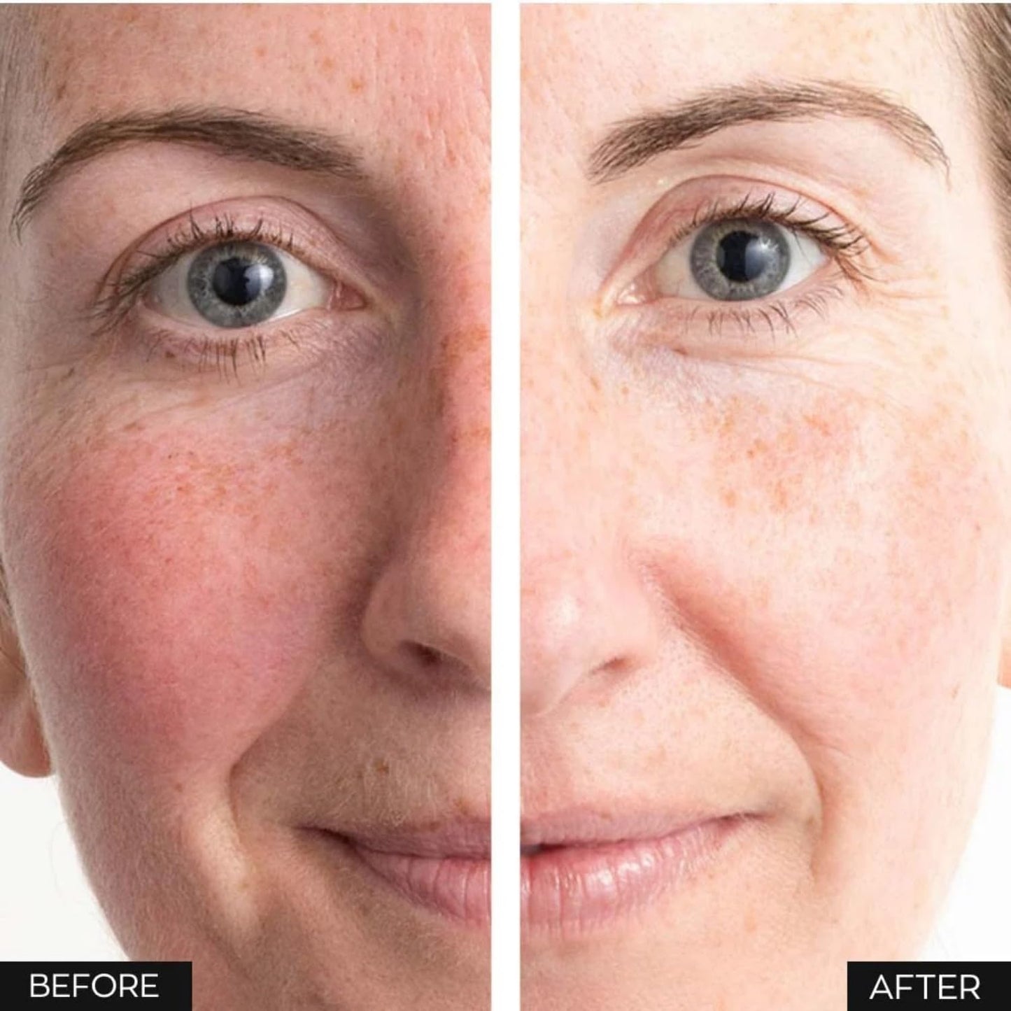 Anew Protinol Power Serum