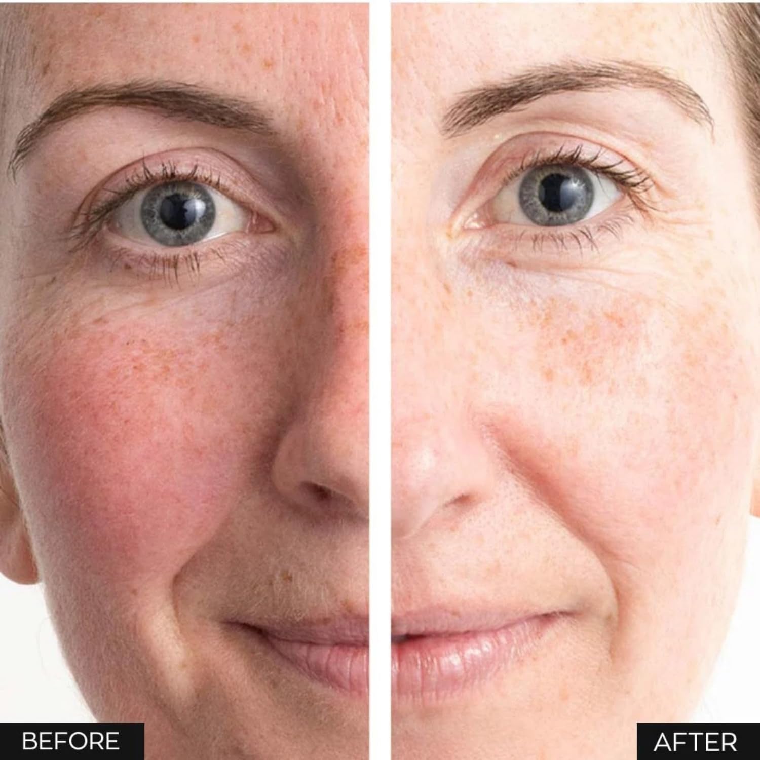 Anew Protinol Power Serum