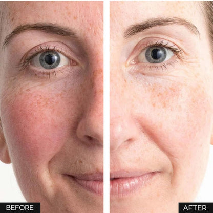 Anew Protinol Power Serum