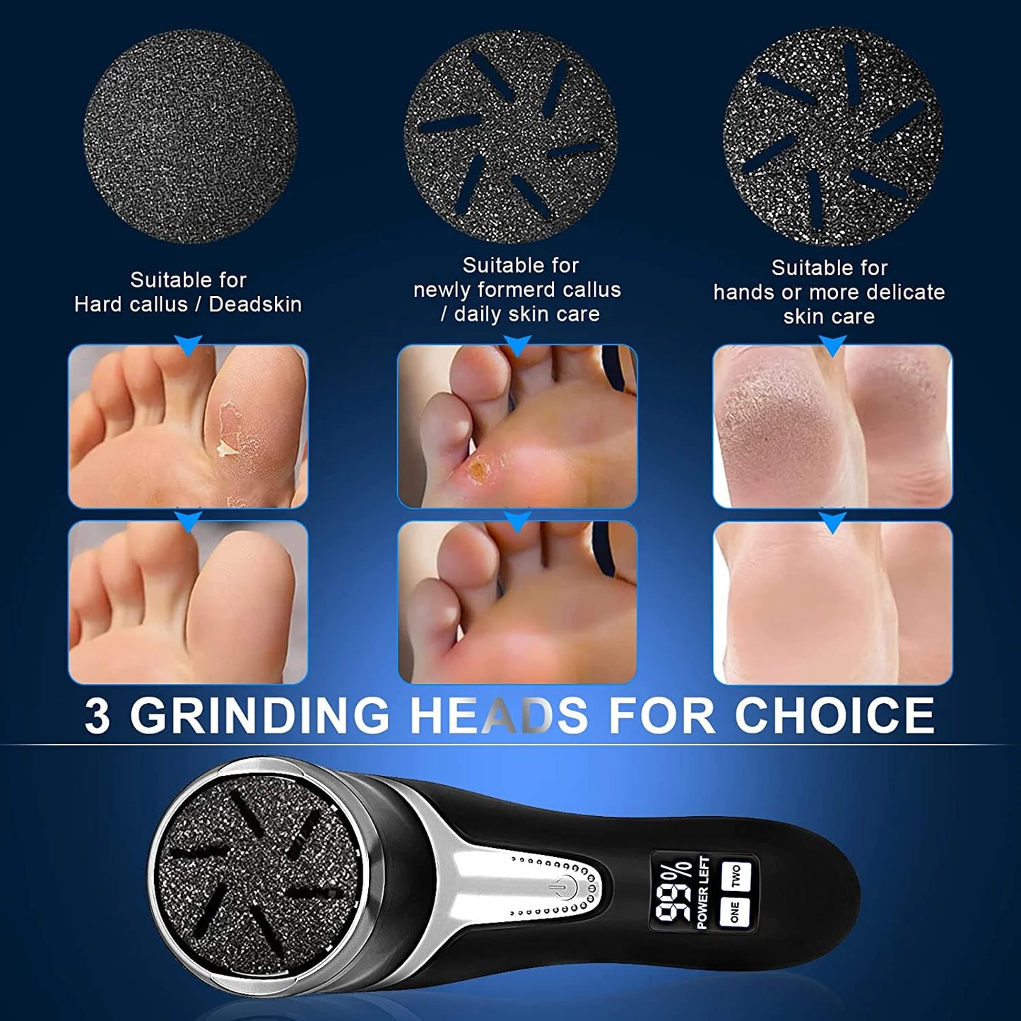 Electric Callus Remover for Feet with Vacuum, Professional Pedicure Tool, Rechargeable 
