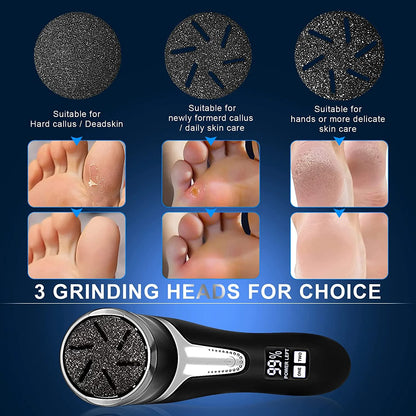 Electric Callus Remover for Feet with Vacuum, Professional Pedicure Tool, Rechargeable 